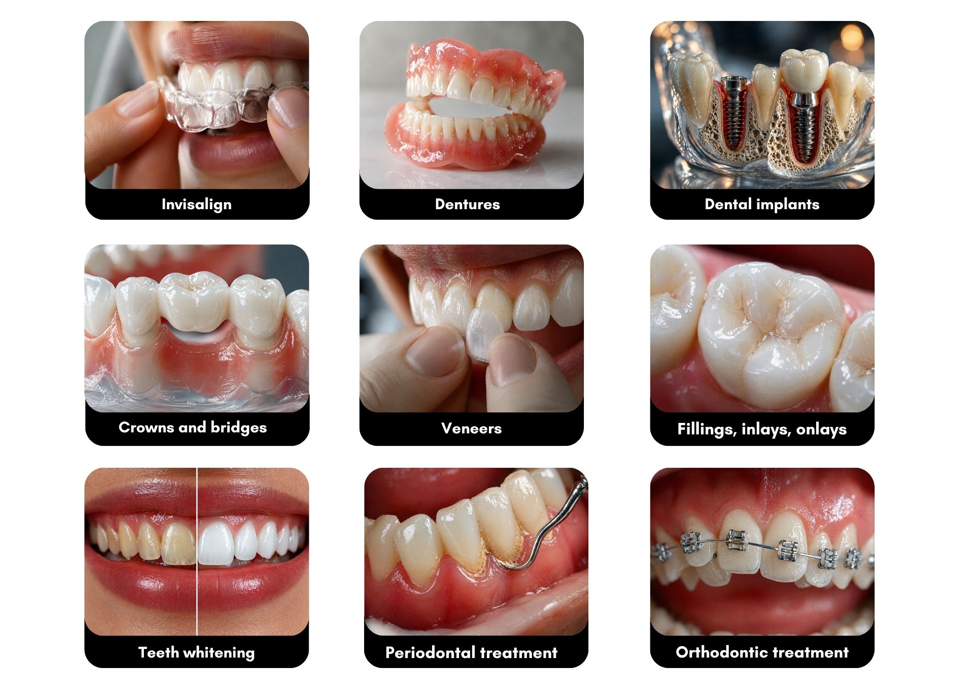 Digital Smile Design Process