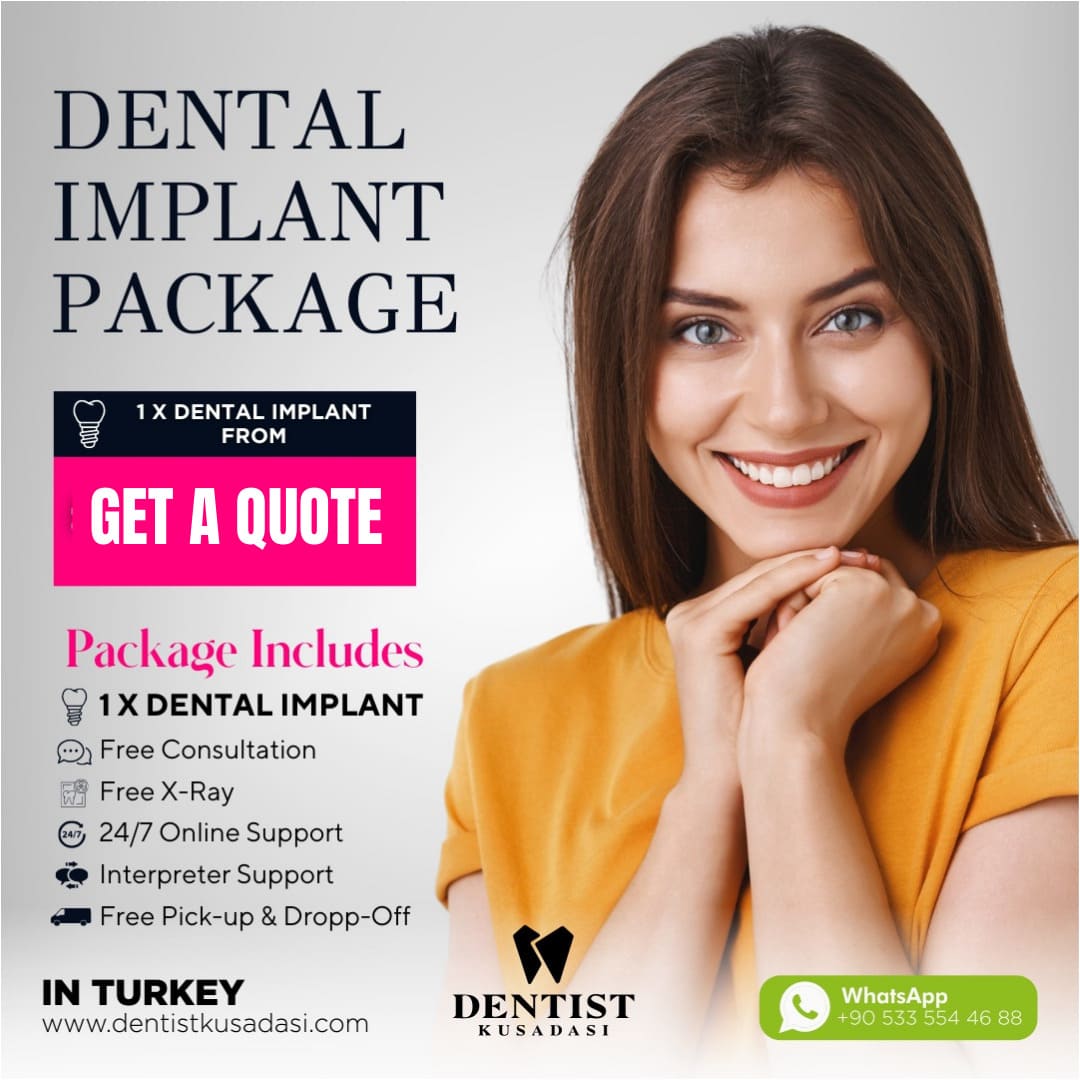 Dental Implant Package Offer