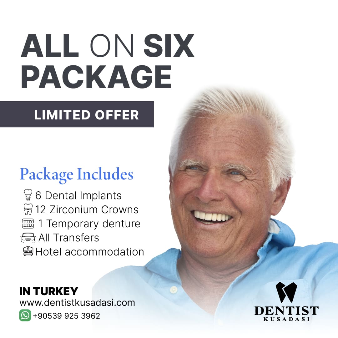 All-on-Six Offer