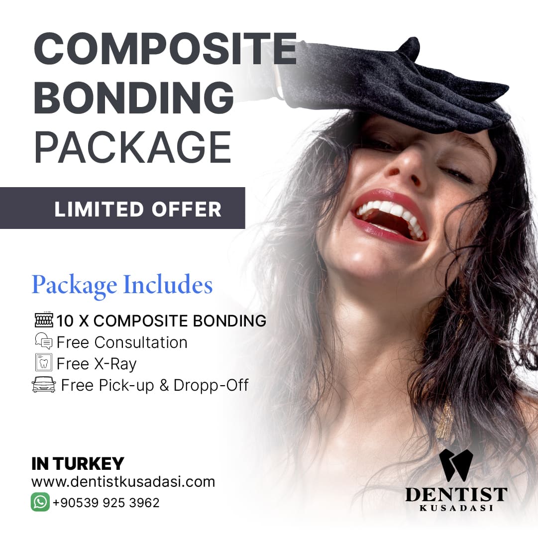 Bonding Veneers Package Offer img