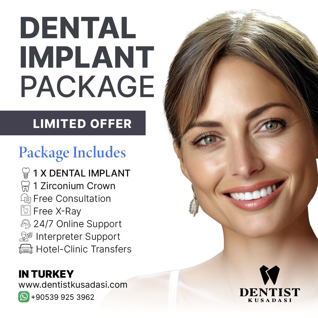Hollywood Smile Offer