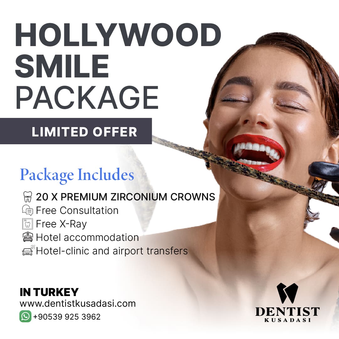 Hollywood Smile Premium Package img