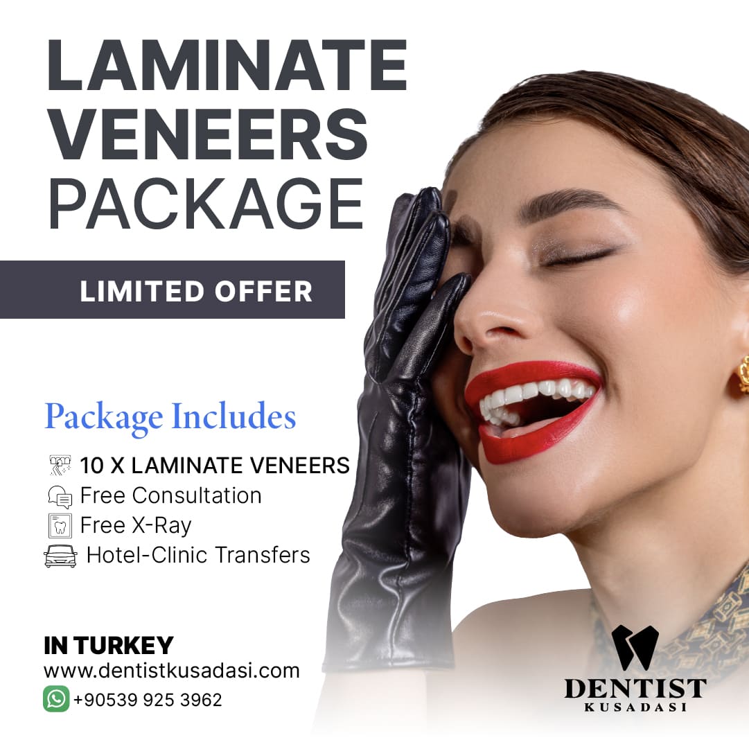 Laminate Veneers Package Offer img
