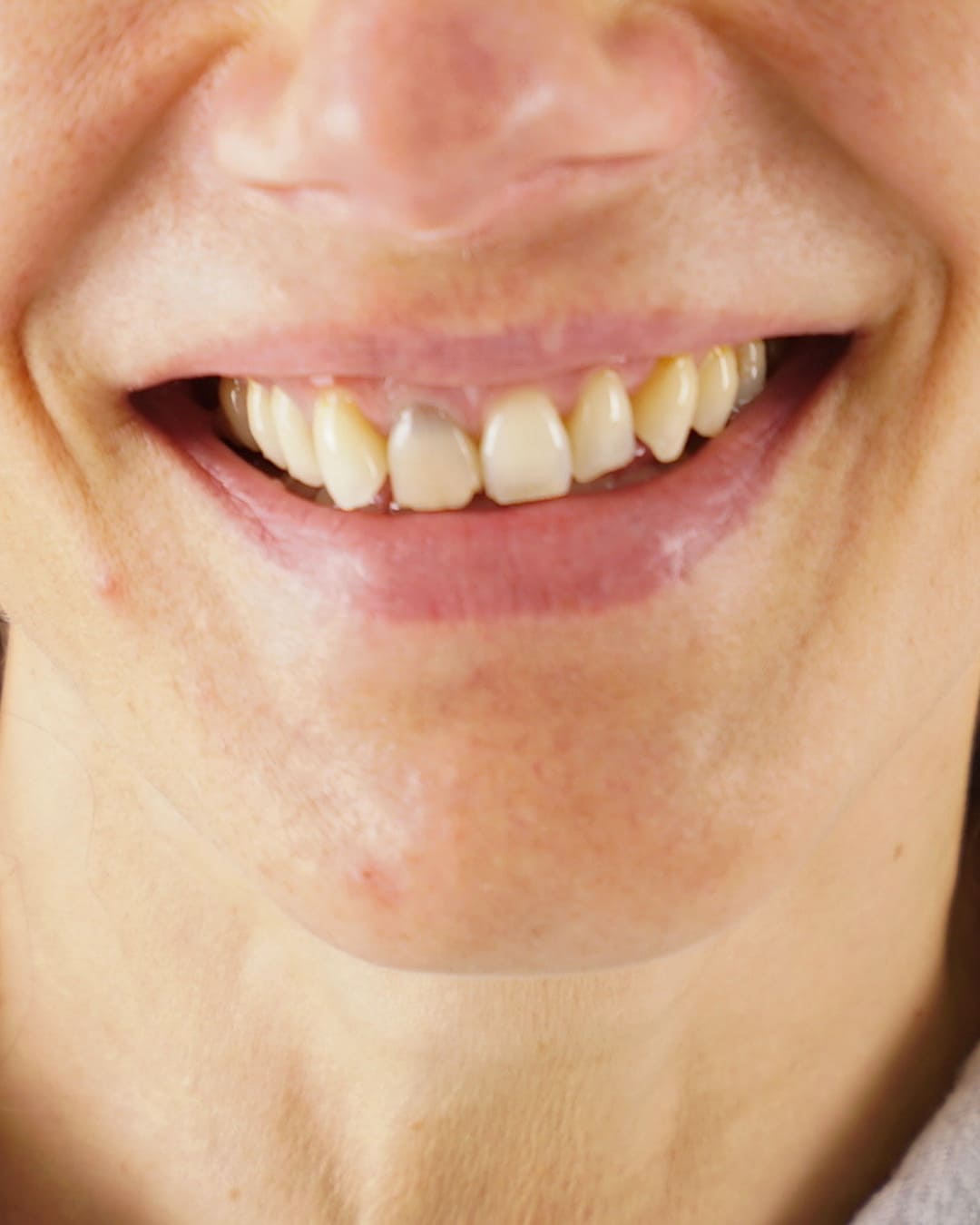 Before Transformation