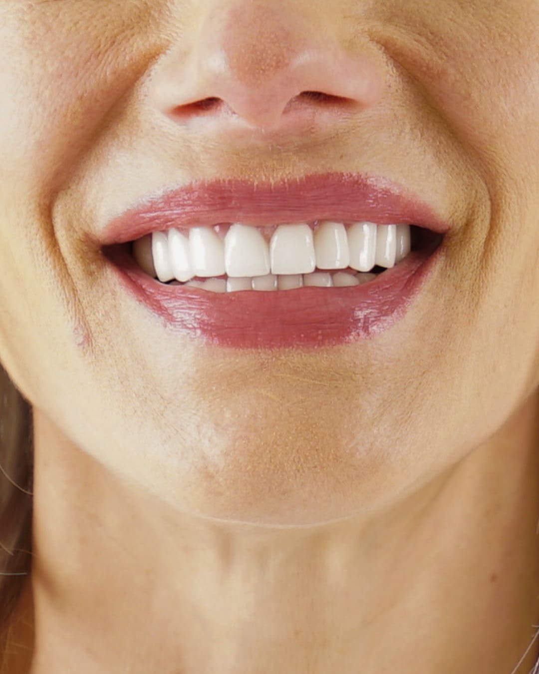 After Transformation