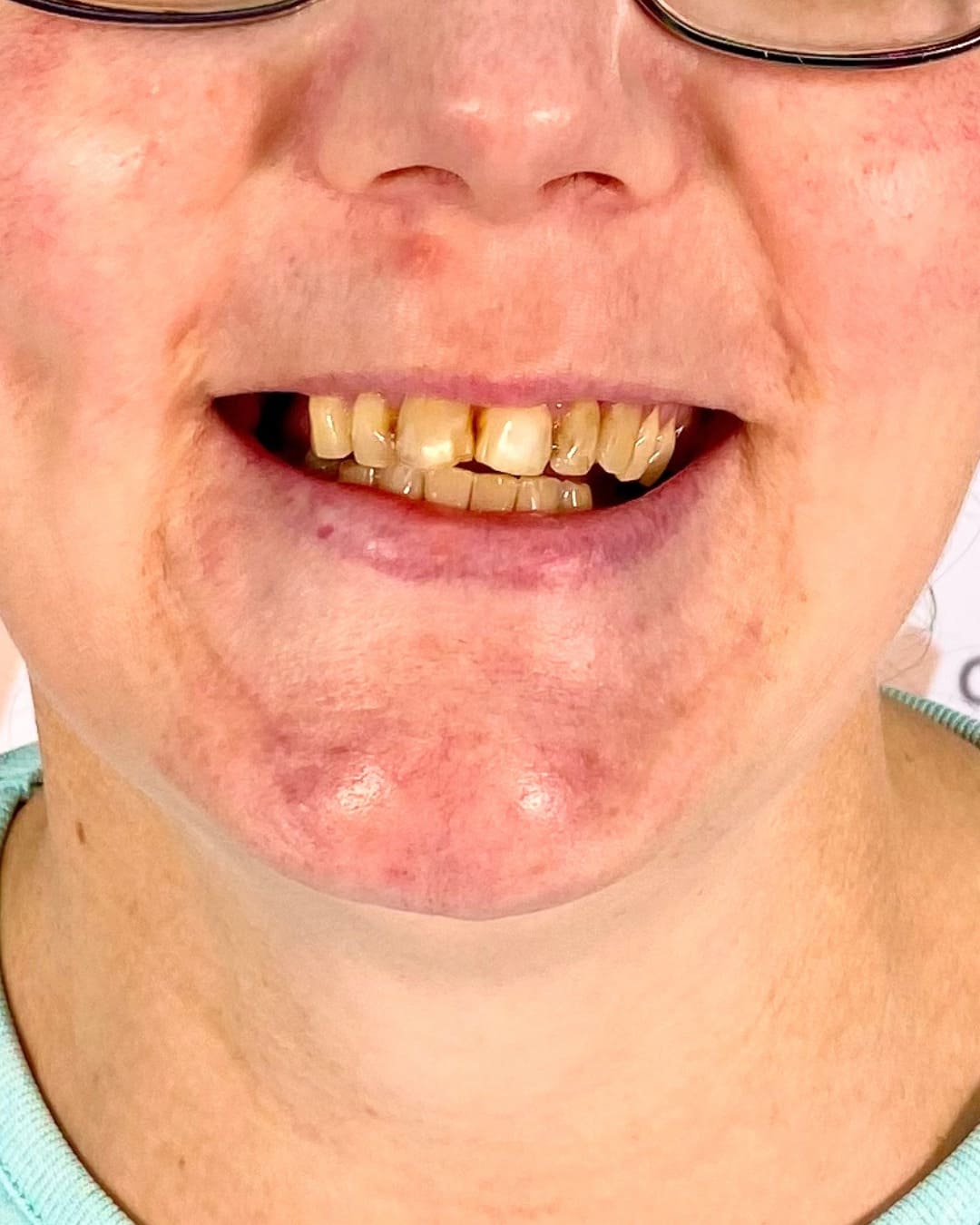 Before Transformation