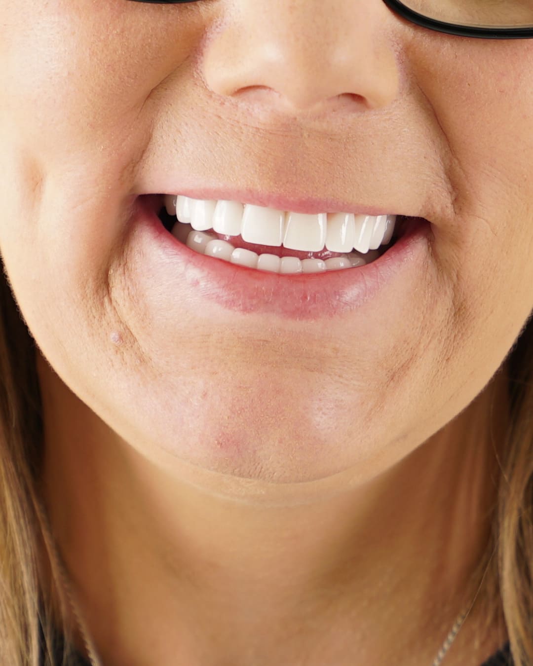 After Transformation