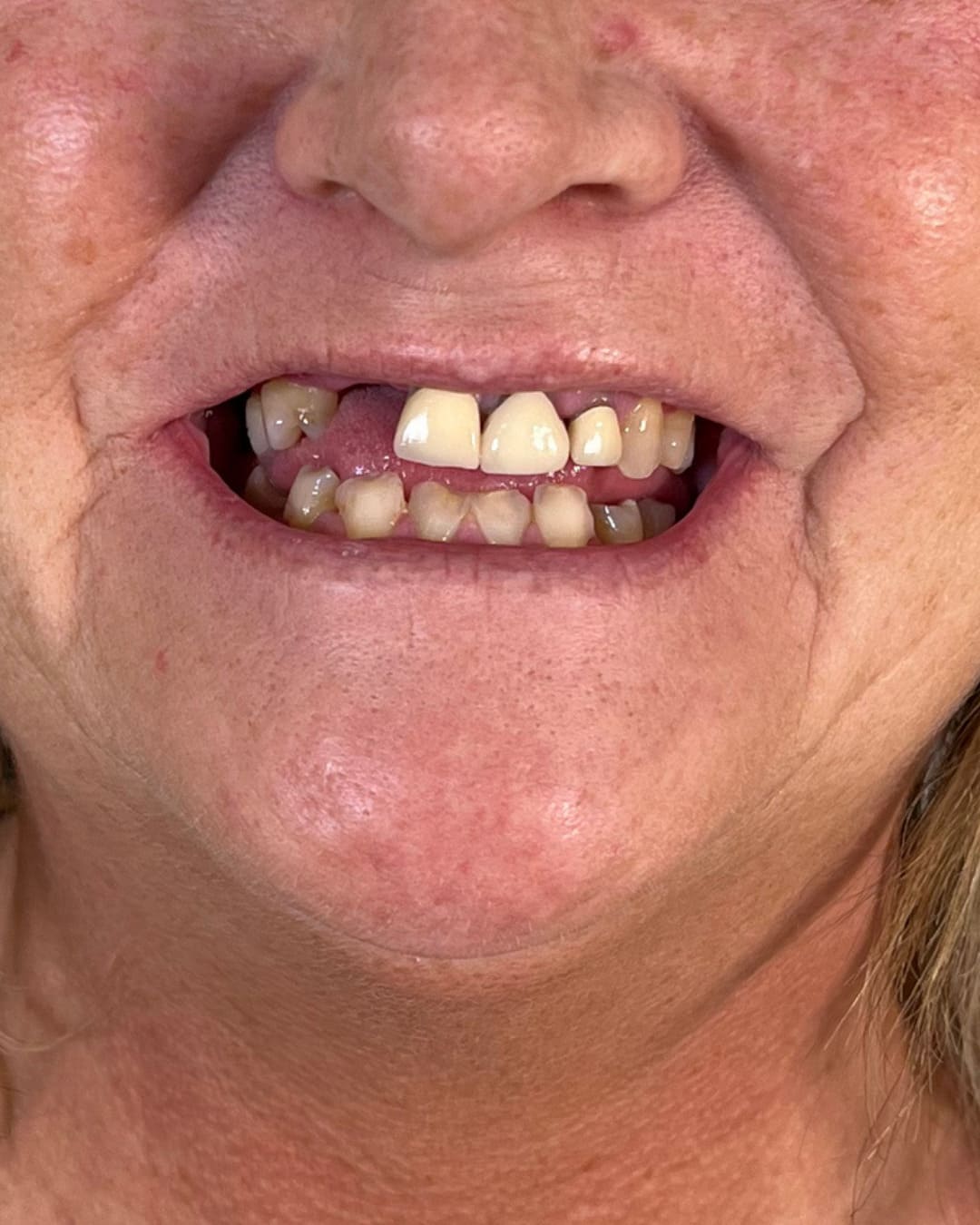 Before Transformation