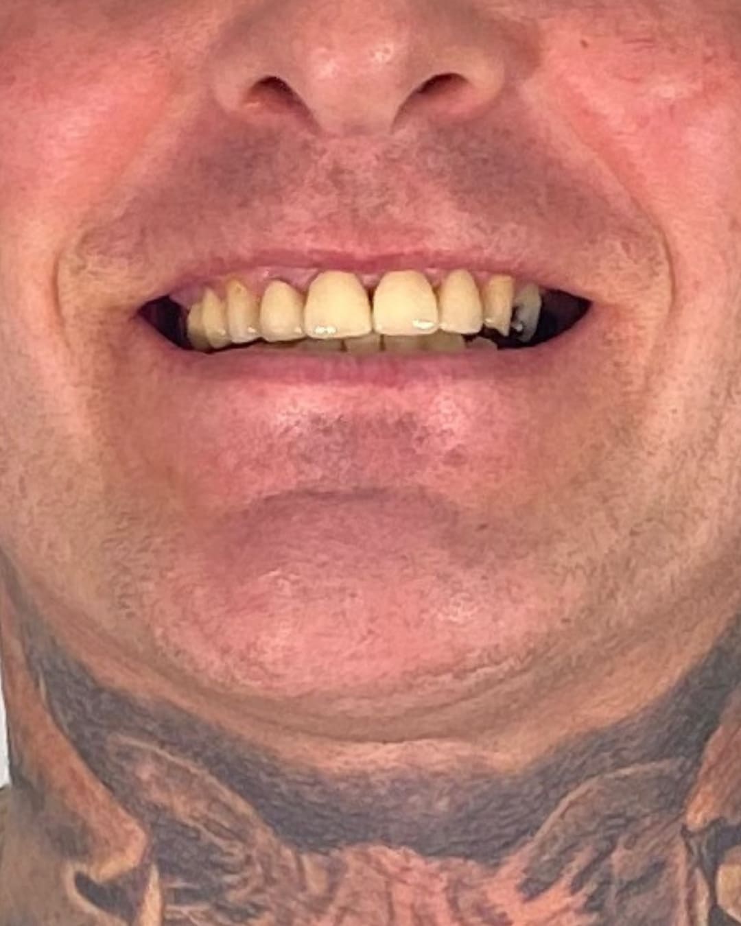 Before Transformation