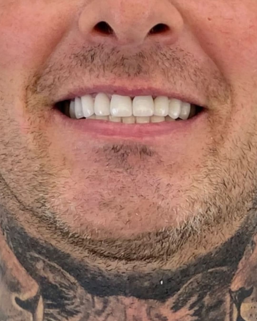 After Transformation