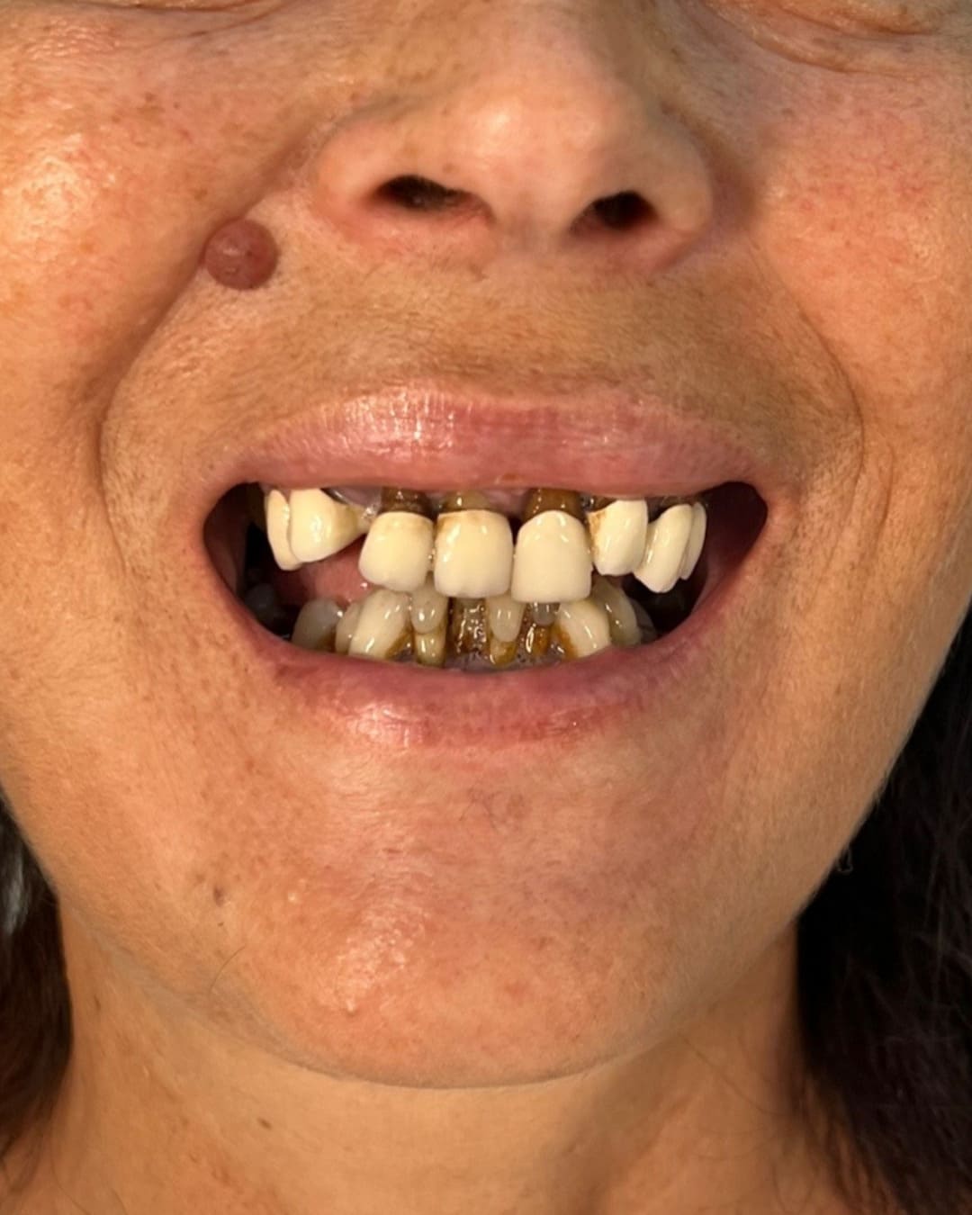 Before Transformation