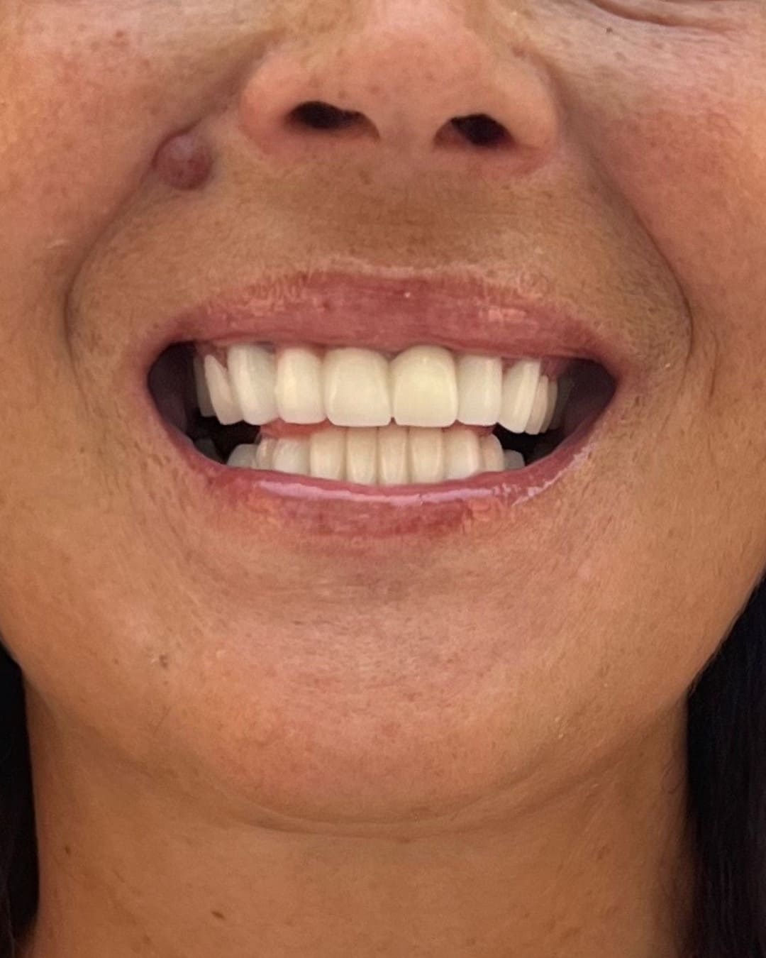 After Transformation